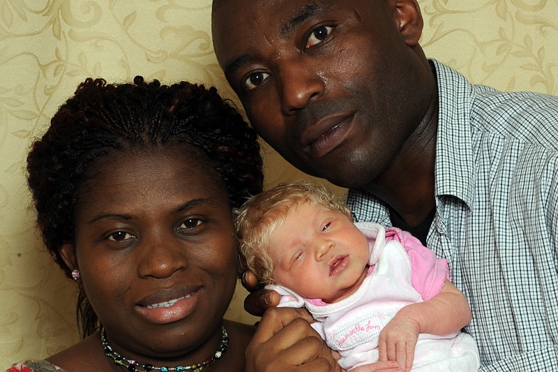 Наука Story: Нигерийская пара рождает белого ребенка
