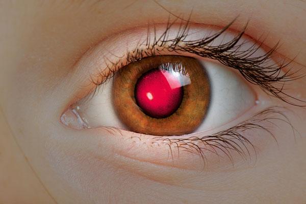 Наука Story: Красные глаза на фото: в чем причина?