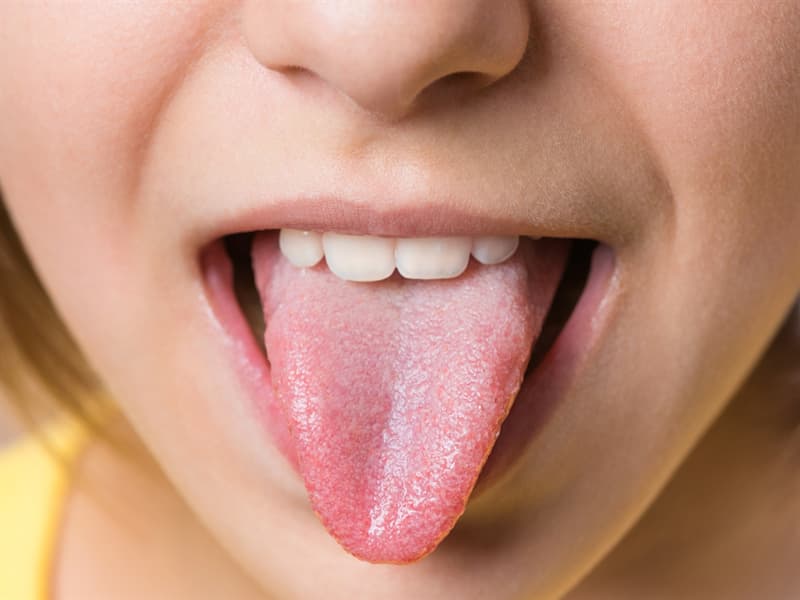 health Story: #2 Examine your tongue