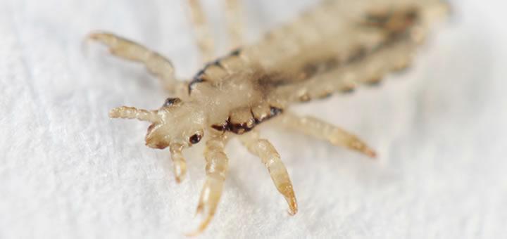 Culture Trivia Question: What is the singular of lice?