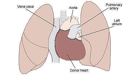Science Trivia Question: What is the name of the hospital where the first human heart transplant in the world occurred?