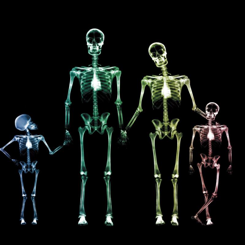 Наука Вопрос: Общеизвестно, что скелет взрослого человека состоит примерно из 206 костей. А сколько костей у новорожденного младенца?