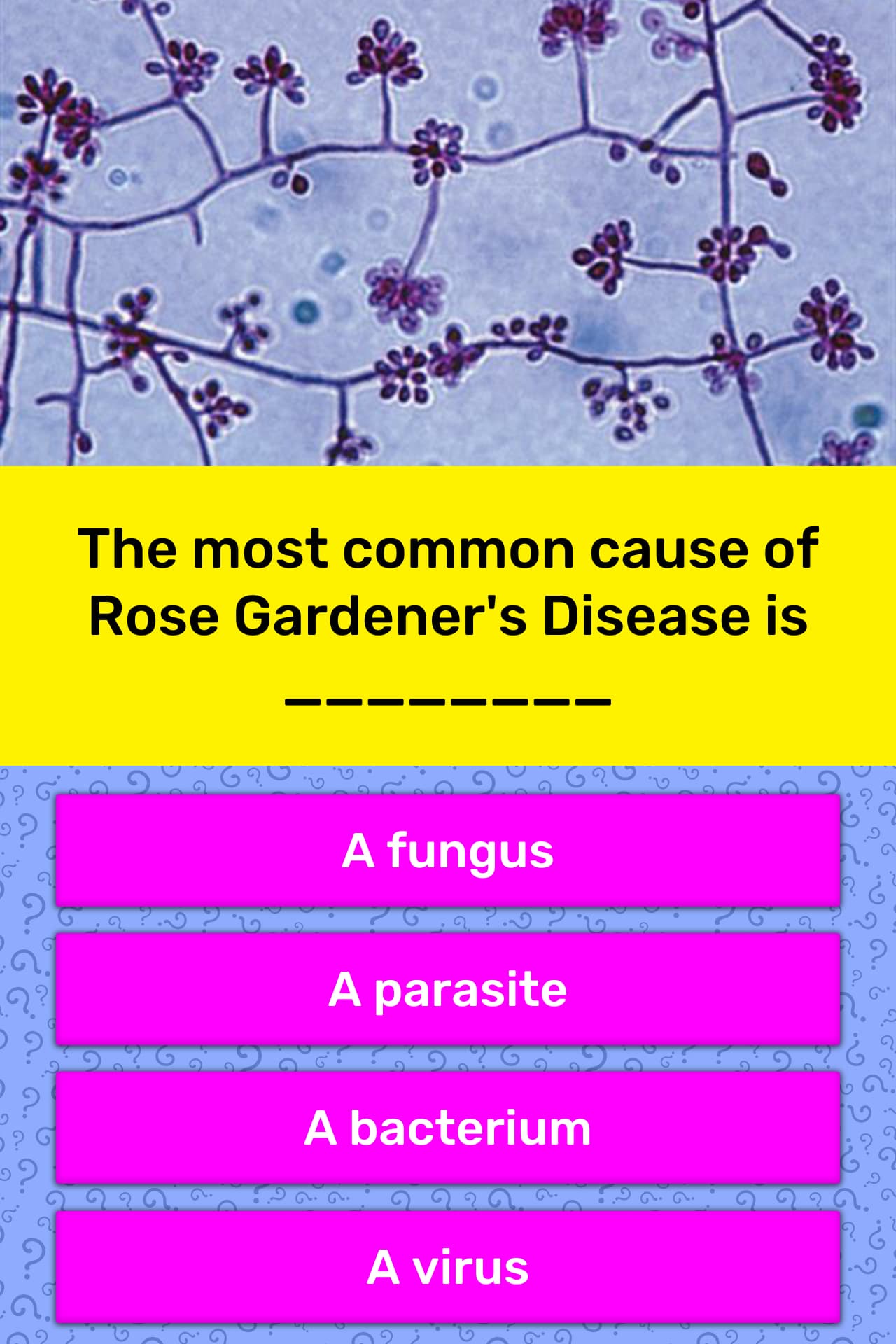 The Most Common Cause Of Rose Trivia Answers Quizzclub