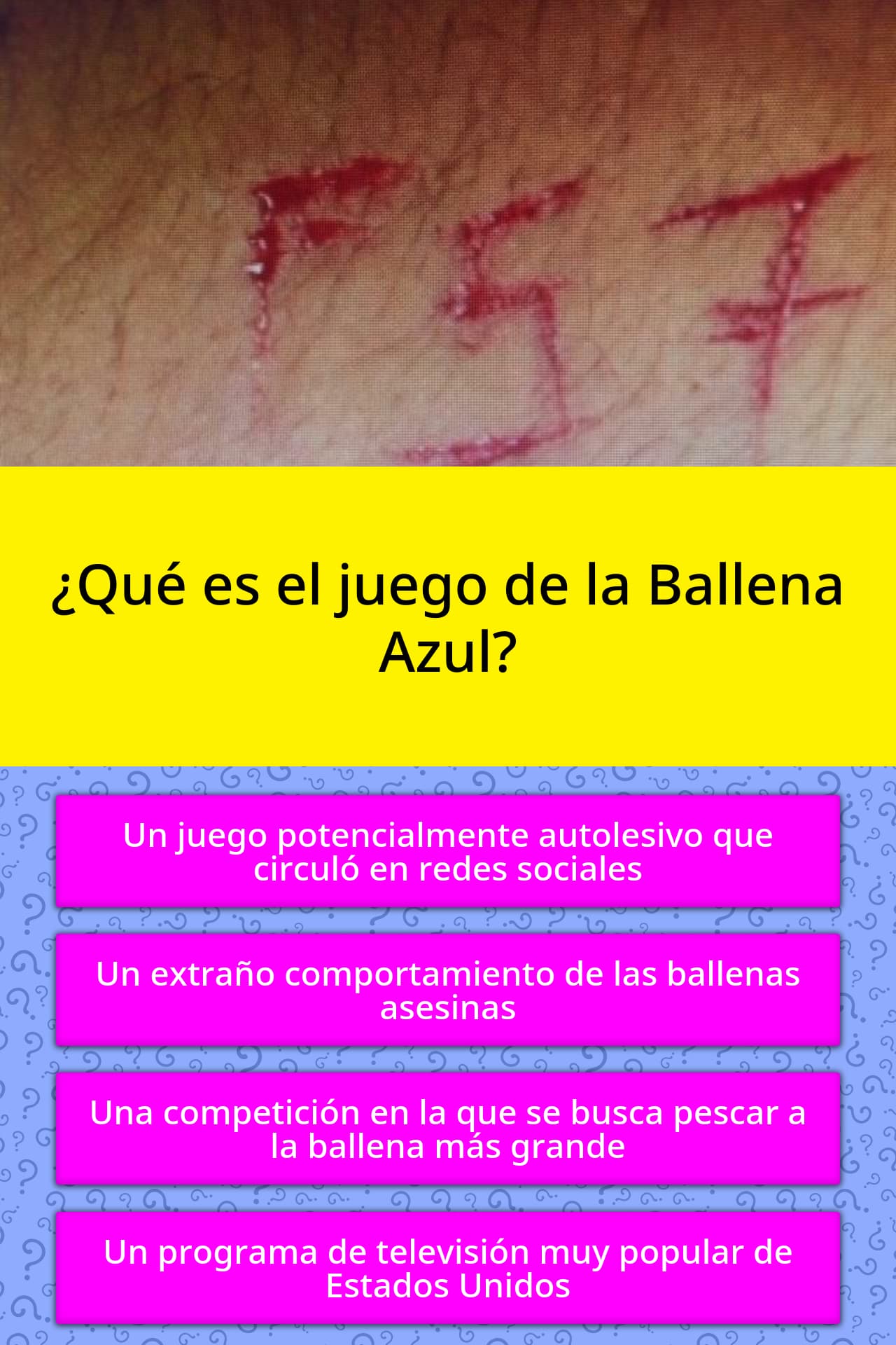 ¿Qué es el juego de la Ballena Azul? Las Preguntas Trivia ¿Qué es el juego de la Ballena Azul? Las Preguntas Trivia