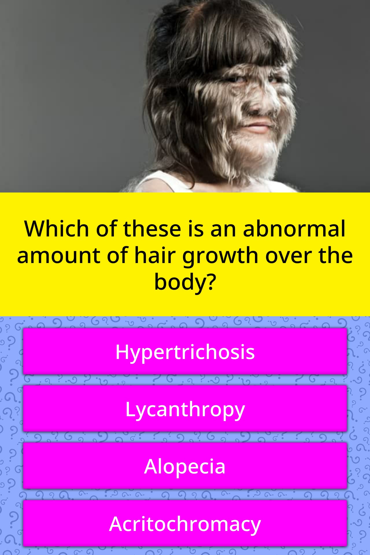 which-of-these-is-an-abnormal-amount-trivia-answers-quizzclub