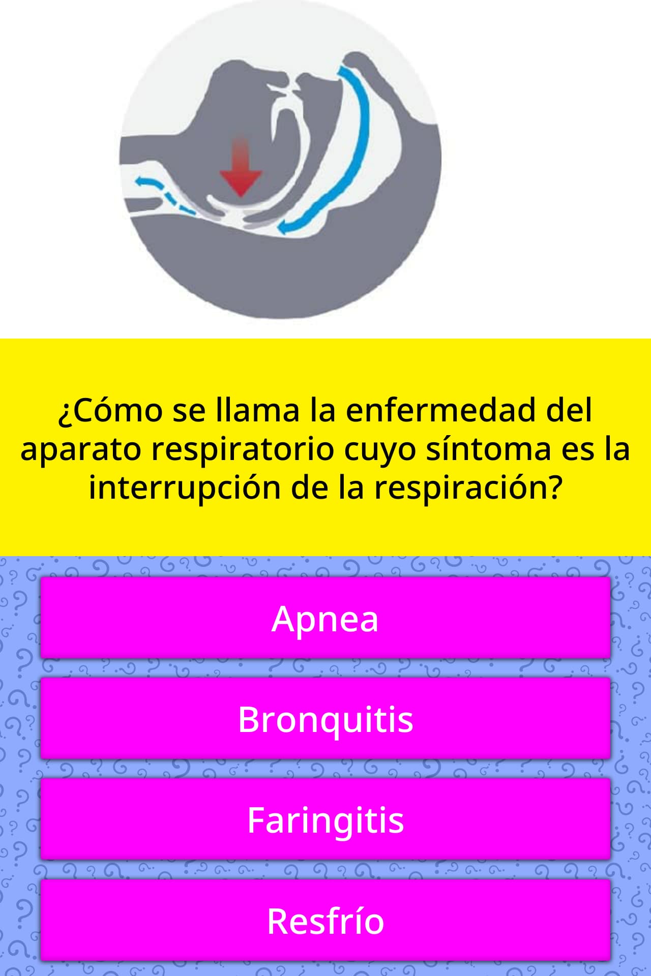 ¿Cómo se llama la enfermedad del... Las Preguntas Trivia