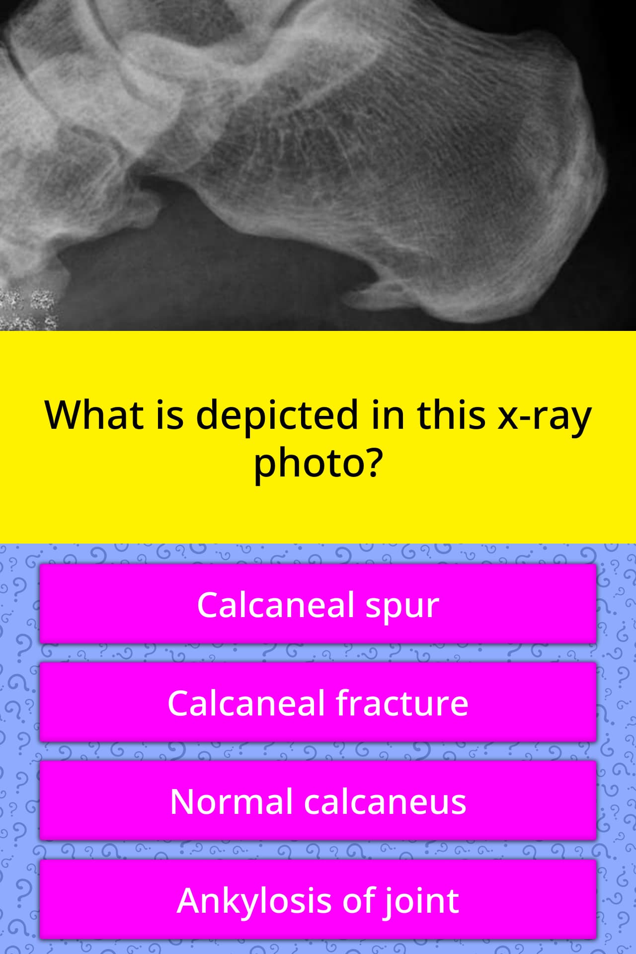 What Is Depicted In This X Ray Photo Trivia Questions Quizzclub