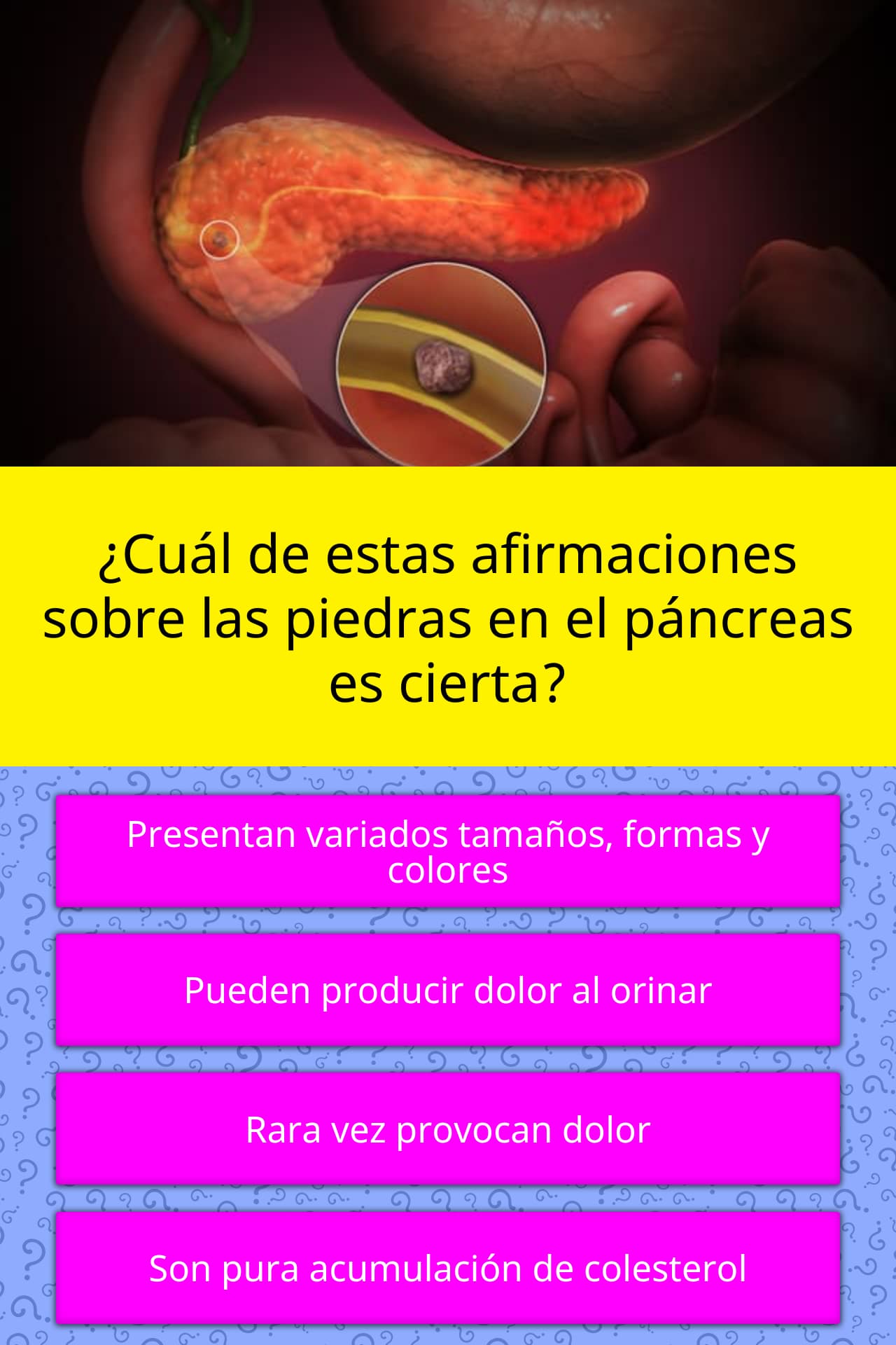 ¿Cuál de estas afirmaciones sobre... La respuesta de Trivia ¿Cuál de estas afirmaciones sobre... La respuesta de Trivia