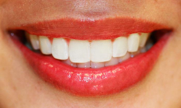Наука Вопрос: Какие зубы появляются раньше - натальные или неонатальные?