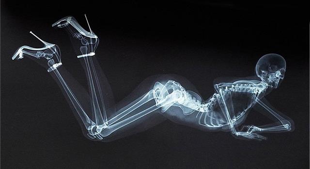 Science Question: La première photographie à rayons X a avoir été prise représentait quelle partie du corps humain ?
