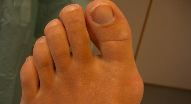 Science Trivia Question: Which one of your toes is also known as your "hallux"?