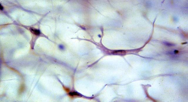 Science Trivia Question: Which of the following cells produce collagen fibers?