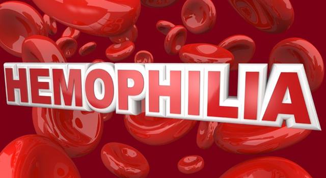 historia Pytanie-Ciekawostka: Kto był pierwszym znanym nosicielem hemofilii?
