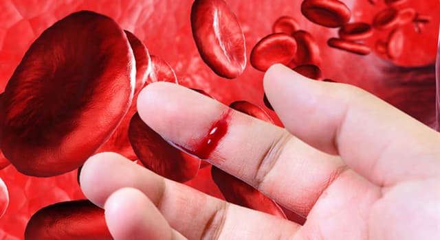Сiencia Pregunta Trivia: ¿Qué es la hemofilia?