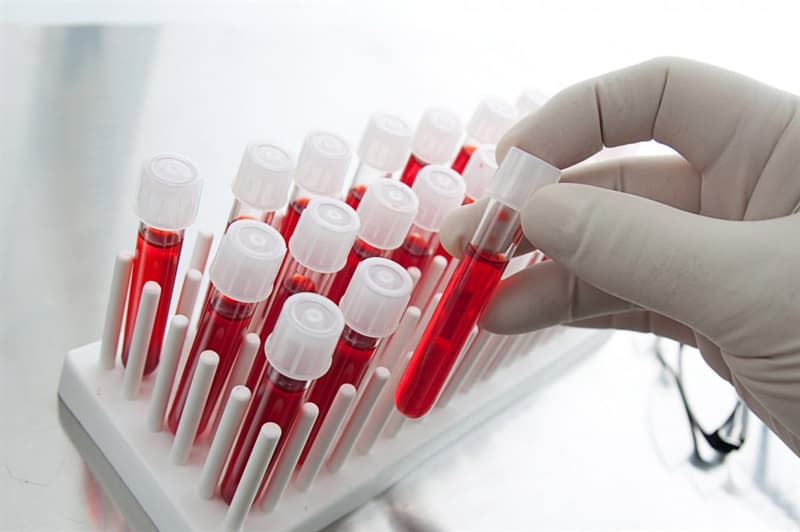 Scienza Domande: L'anemia è causata dalla carenza di cosa?