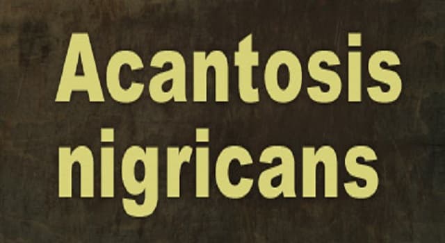 Сiencia Pregunta Trivia: ¿Qué es la acantosis nigricans?