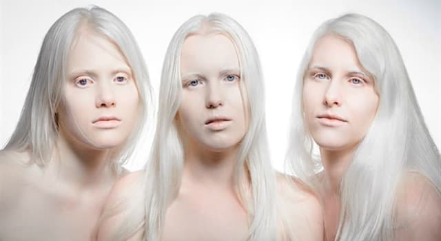 Science Question: Comment s'appelle une personne sans pigmentation ou coloration ?