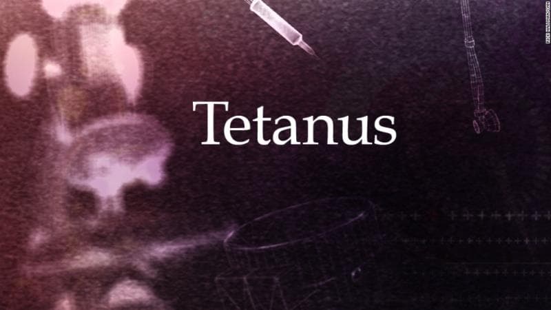 科學 小問題：Tetanus又名什麼?