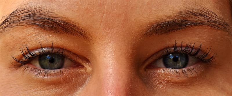 Science Trivia Question: What type of muscle surrounds the pupil causing it to constrict?