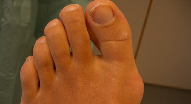 科學 小問題：你的哪個腳趾也被稱為“ hallux”？