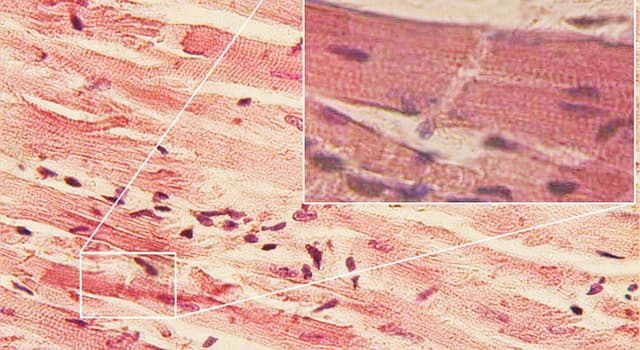 Wetenschap Trivia Vraag: Wat is de medische naam van het spierweefsel van de hartspier?