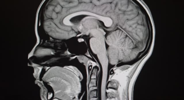 Science Question: Quelle glande se trouve juste en dessous du chiasma optique de votre cerveau ?
