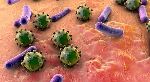 Wetenschap Trivia Vraag: Welke aandoening treedt op als ontstekingsreactie van het hele lichaam op een infectie?