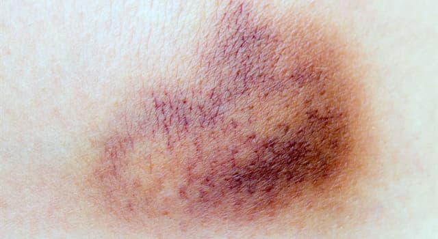 Nature Trivia Question: Why do bruises change colour?