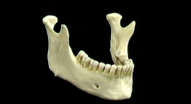 Science Trivia Question: In former times, which workers were prone to a condition known as "phossy jaw"?