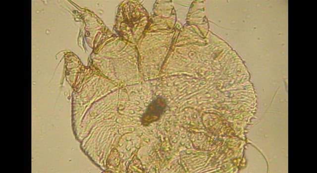 Wetenschap Trivia Vraag: Schurft is een besmettelijke ziekte die welk deel van het menselijk lichaam aantast?