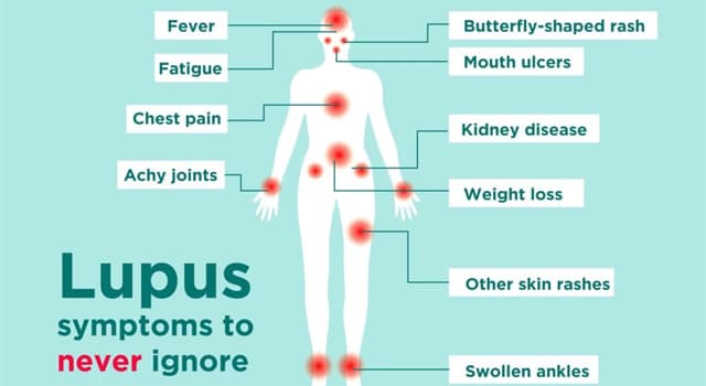 Wetenschap Trivia Vraag: Wat voor soort ziekte is Lupus (systemische lupus erythematodes)?