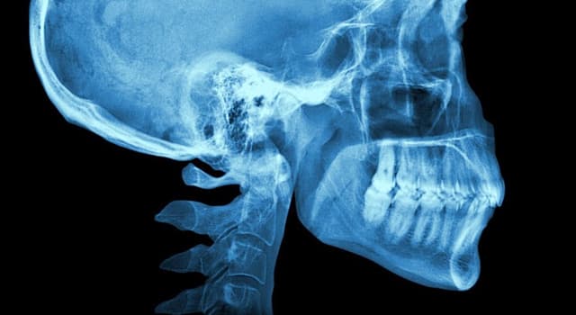 Cultura Pregunta Trivia: ¿Qué es un negatoscopio?