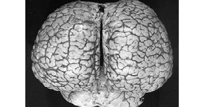 자연 상식 퀴즈: 지구상에서 가장 큰 뇌를 가지고 있는 동물은?