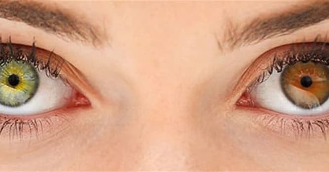 Science Question: Comment appelle-t-on une différence de couleur entre l'iris des deux yeux ?