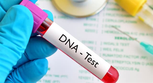 Wetenschap Trivia Vraag: De naam van de vorm die de structuur van een DNA-molecuul beschrijft, is een 'dubbele ...' wat?