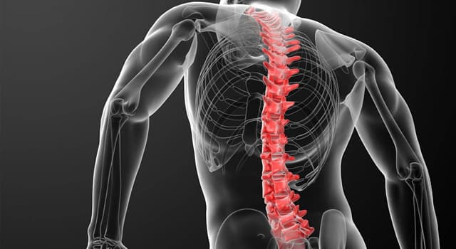 Wetenschap Trivia Vraag: Hoe heet de aandoening waarbij iemands wervelkolom in drie dimensies gebogen is?