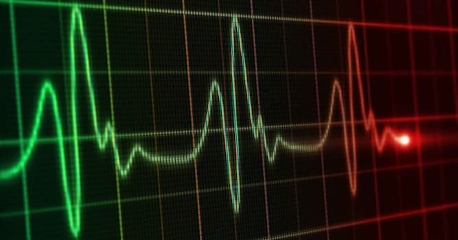 Наука Вопрос: Как называется увеличение частоты сердечных сокращений?