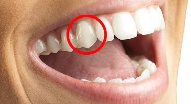 Наука Вопрос: Как называются конусовидные зубы, которые служат для разрывания и удержания пищи?