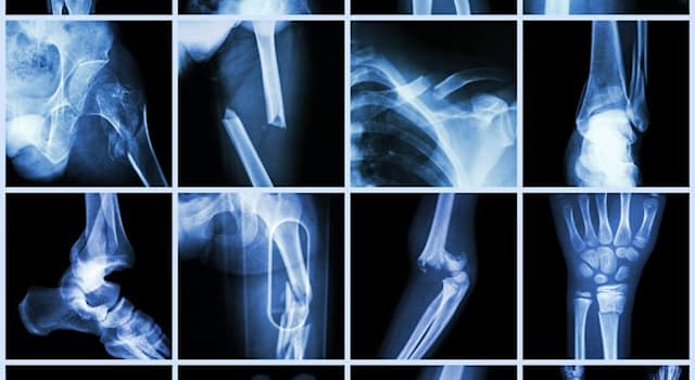 Science Trivia Question: An injury known as a Potts fracture occurs to which part of the body?