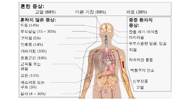 사회 상식 퀴즈: 코로나-19가 처음 시작된 국가는?