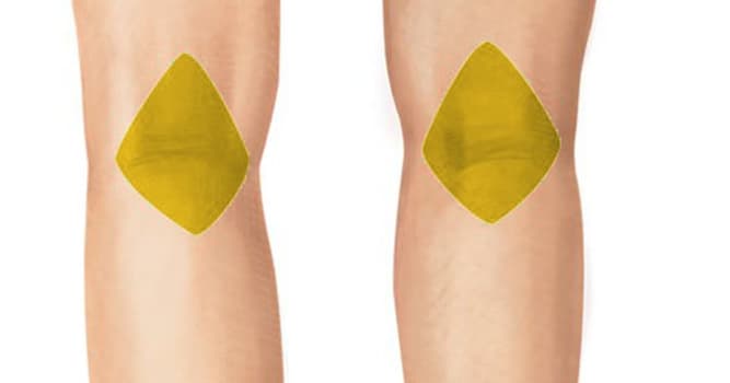 Spor Trivia Sorusu: Popliteal fossa vücudun neresinde bulunur?