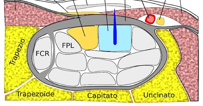 Bilim Trivia Sorusu: Karpal tünel nedir?