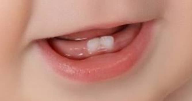 Сiencia Pregunta Trivia: ¿Cómo se llaman los dientes que ya están presentes en el bebé en el momento del nacimiento?