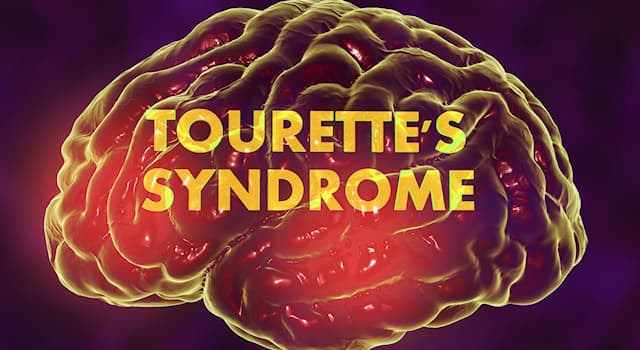 Сiencia Pregunta Trivia: ¿Cómo se manifiesta el Síndrome de Tourette?