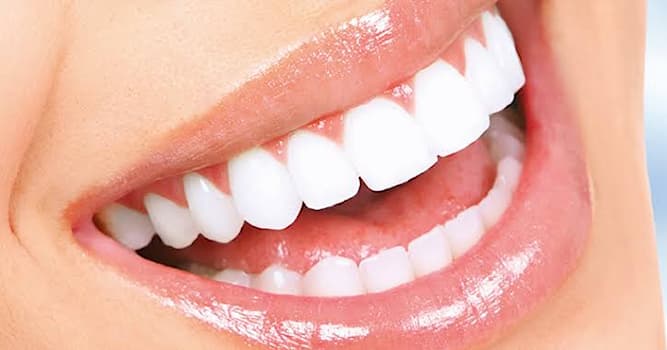 Maatschappij Trivia Vraag: Hoe heet de procedure om tanden wit te maken?