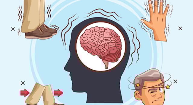 과학 상식 퀴즈: 파킨슨병이란 무엇인가?