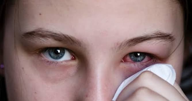 Wetenschap Trivia Vraag: Wat is conjunctivitis?