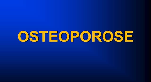 Vetenskap Triviafråga: Vad är osteoporos?