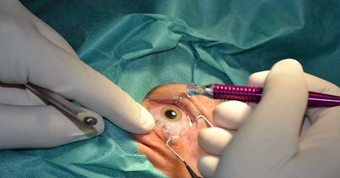 Maatschappij Trivia Vraag: Als je een oogarts moet bezoeken, wat is je probleem?